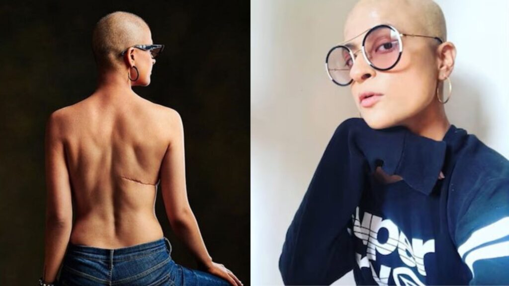 Tahira Kashyap Breast Cancer